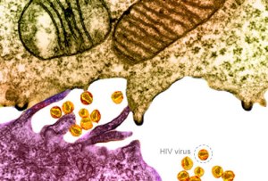 hiv_virus